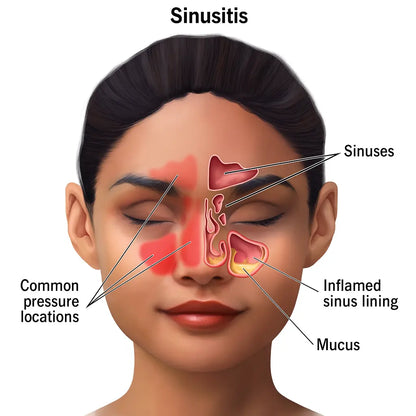 Kenor BreatheBeam™   Red Light Nasal Therapy